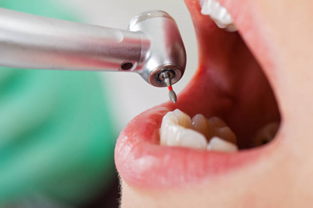 Best Emergency Gum Treatment in Desert Edge, CA